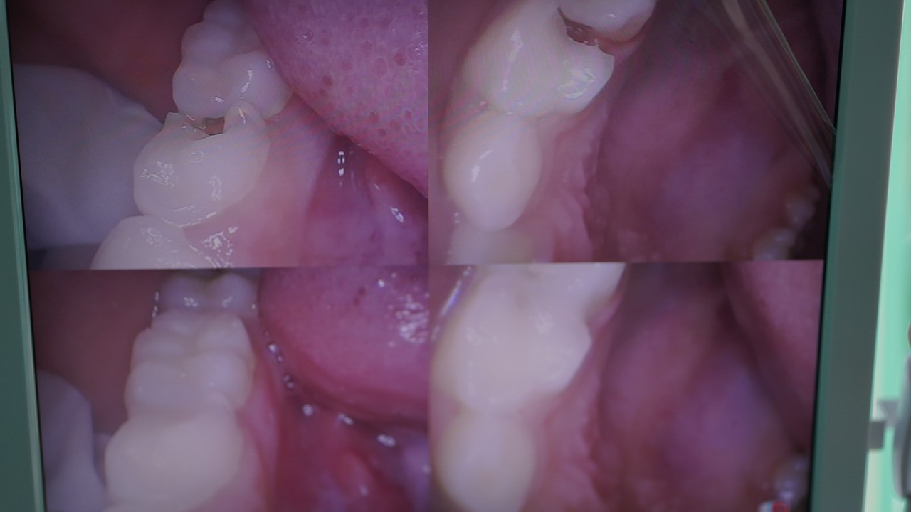 Csbva7p0taxql8gcscwghxd8jvsdlbqa9xtdqomolza