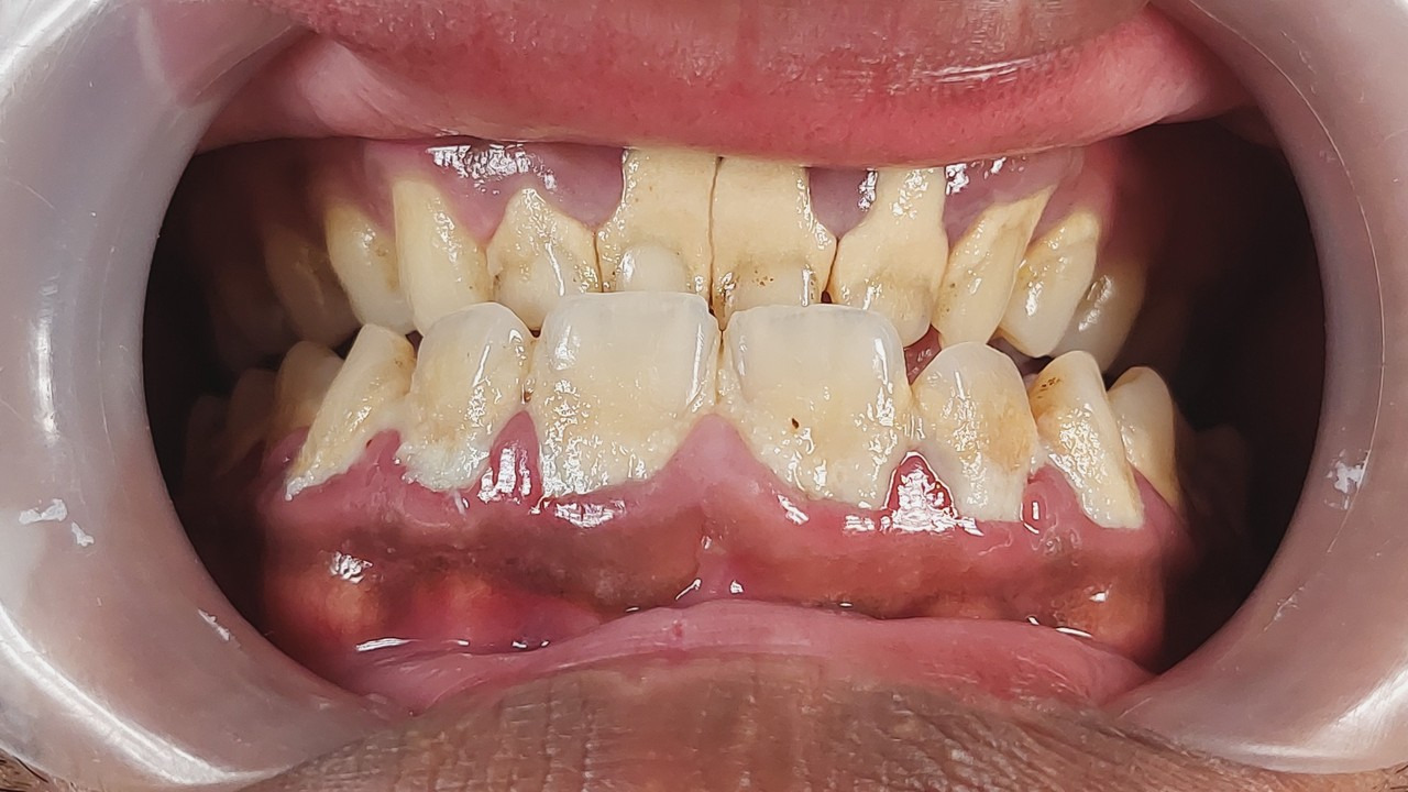 Cycibch1muso0skcycmhqdrtrvmlf6q3ms8uqgmicmkq