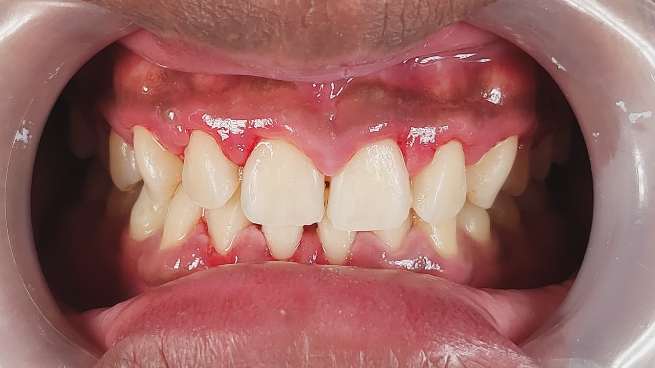 Cycsppszblxlhnlcycm7hbfryedftjyrlep5harjyq