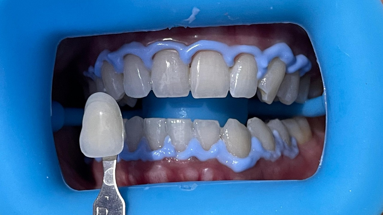 Cychp8fqebyyhbmcycefuizxocukhpsmq2gp3n3pivra