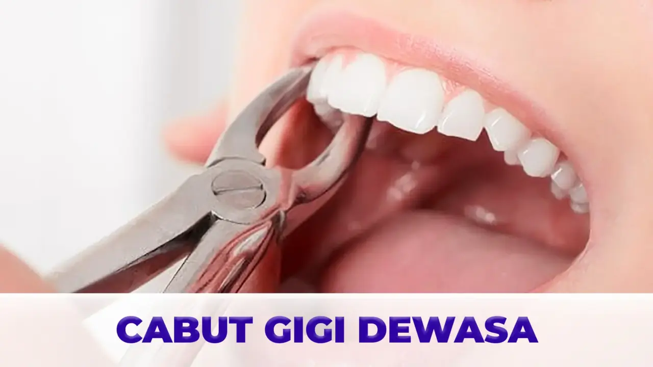 Layanan Cabut Gigi Dewasa Gigio