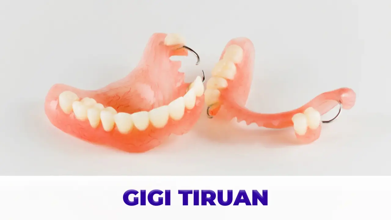 Layanan Gigi Tiruan Gigio