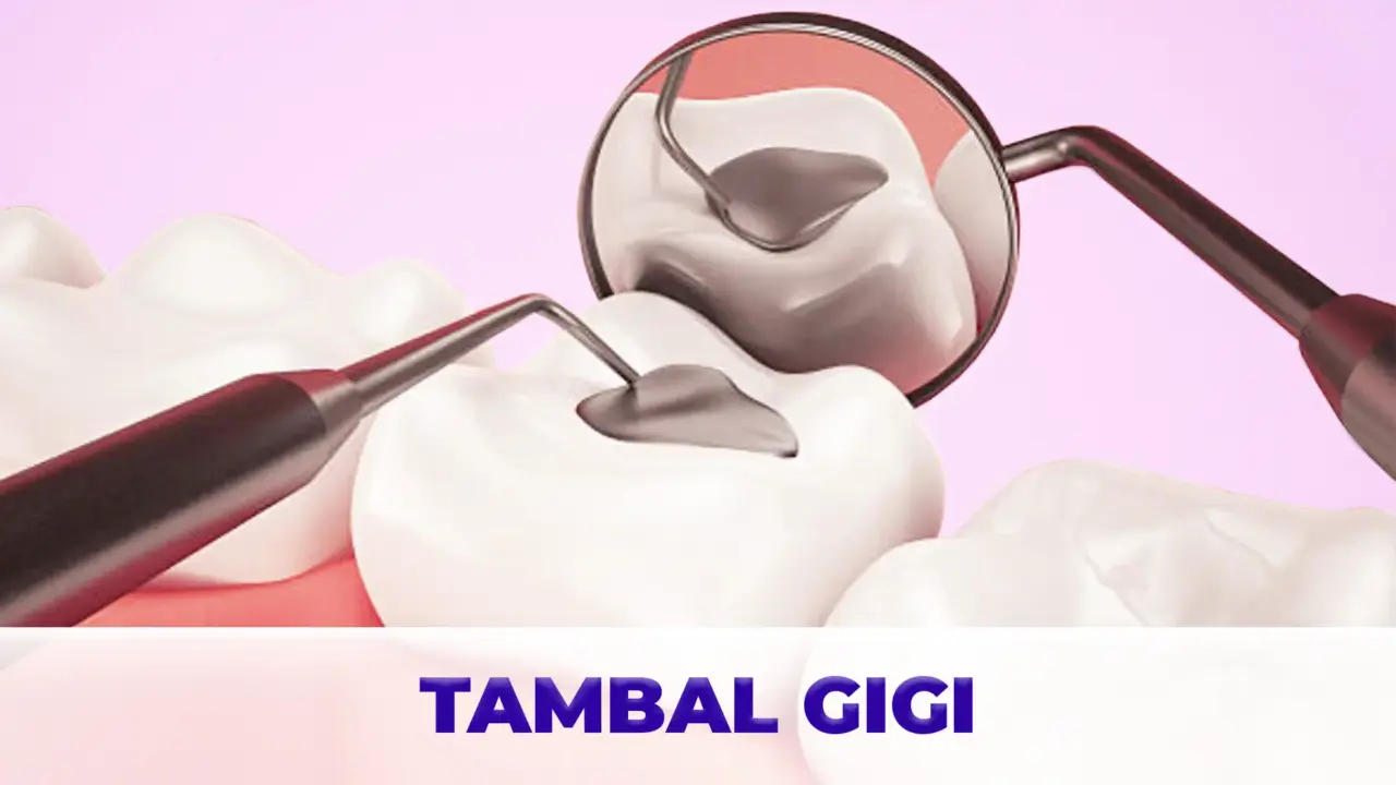Layanan Tambal Gigi Gigio