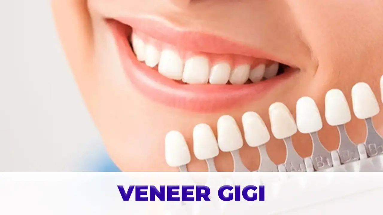 Layanan Veneer Gigi Gigio