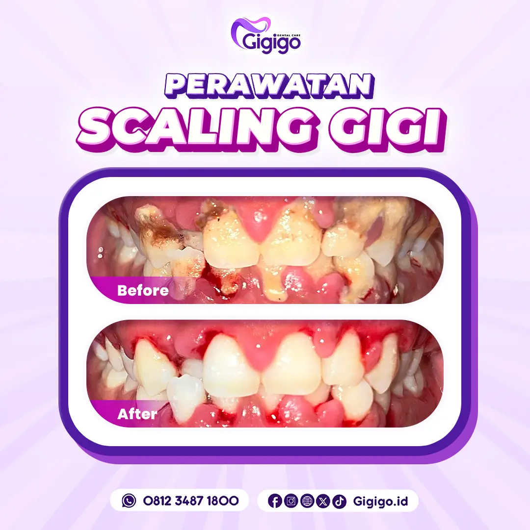 Web before after scaling a