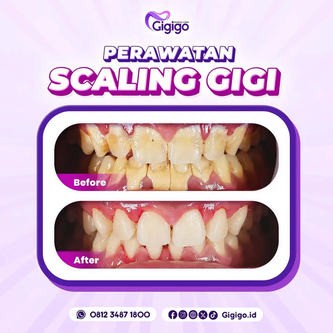 Web before after scaling b