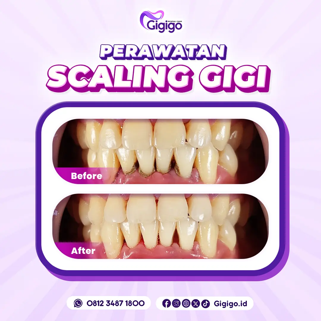 Web before after scaling c